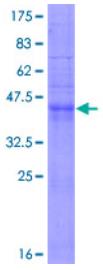 SDS-PAGE (CD9-0882H).jpg